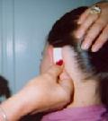 Ear Tucks - Apply Adhesive Strips